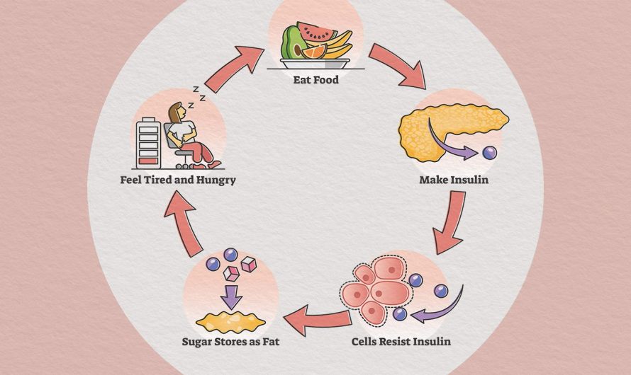 What Role Does Insulin Resistance Play In Different Diabetic Types?